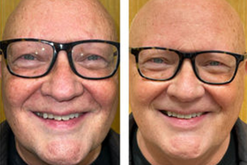 dr le before after reveal